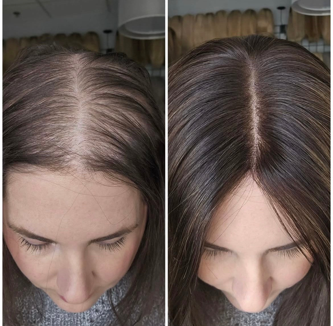 Is It Time to Consider Alternative Hair? Key Signs & What to Know First